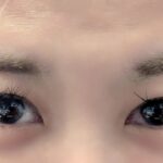 サウナで蔓延するウイルス性結膜炎の危険性と対策とは？